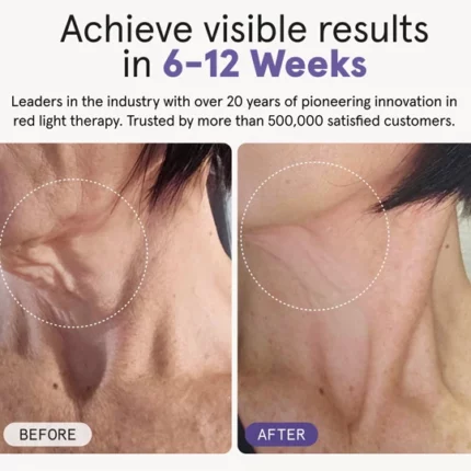 Illumina Neck & Chest Mask